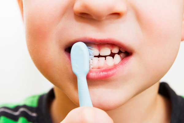 تدابیر پیشگیرانه برای جلوگیری از آسیب به دندان‌های شیری کودکان